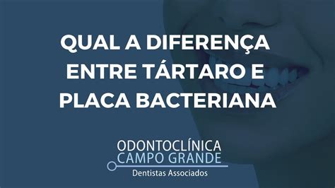 Qual a diferença entre tártaro e placa bacteriana Odontoclinica Campo