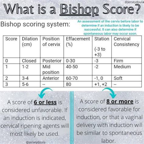 Bishop Score Table Medizzy