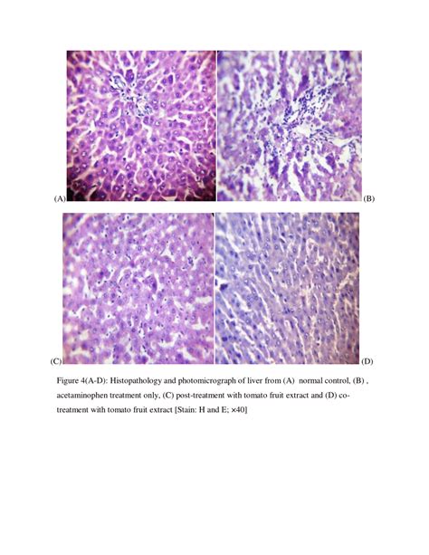 Histopathology And Photomicrograph Of Liver Download Scientific Diagram