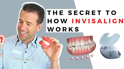 Invisalign How It Works Behind The Scenes What An Orthodontist