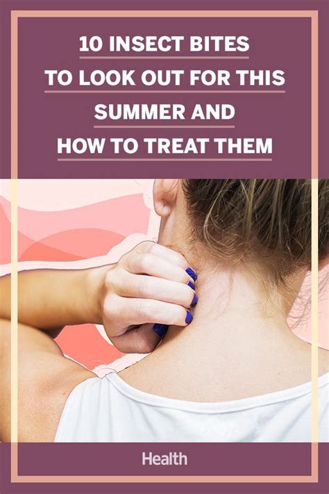 10 Types Of Bug Bites To Watch Out For This Summer Health Tips