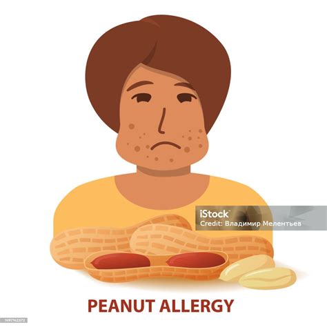 Nut Allergy Symptoms Problem Swollen Man Character Stock Illustration Download Image Now Istock