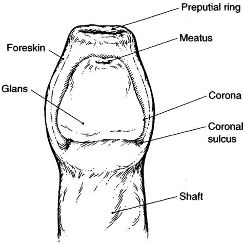 Coronal Sulcus