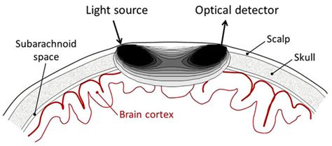 Photonics Free Full Text A Mini Review On Functional Near Infrared