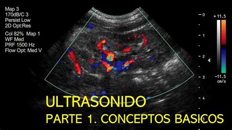 Ultrasonido Conceptos B Sicos Youtube