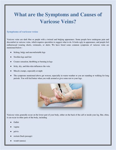 Ppt What Are The Symptoms And Causes Of Varicose Veins Powerpoint