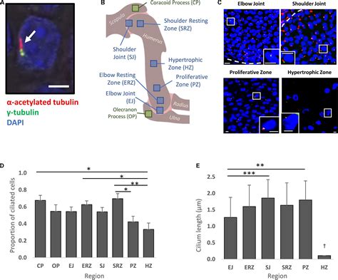 Frontiers The Primary Cilium On Cells Of Developing Skeletal