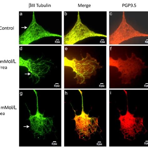 Similar to Figure 3 Higher magnification images of βIII tubulin and