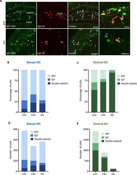 Frontiers Npy Released From Gaba Neurons Of The Dentate Gyrus