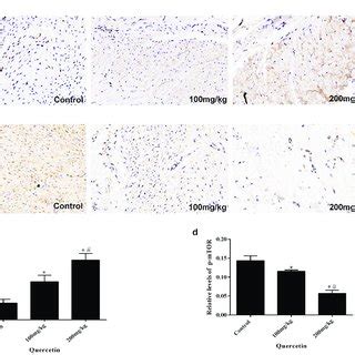 Immunohistochemical Staining Of Lc And P Mtor In Epidural Fibrosis