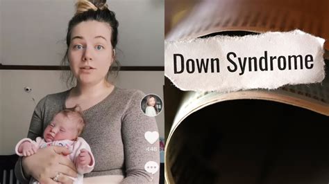 Viral Mom Discovers She Herself Has Down Syndrome