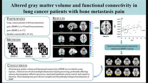 Altered Gray Matter Volume And Functional Connectivity In Lung Cancer