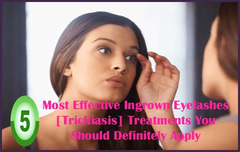 Most Effective Ingrown Eyelashes Trichiasis Treatments You Should