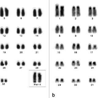 Karyotype After C Banding Of A Male Of Mus Musculus With N Fn