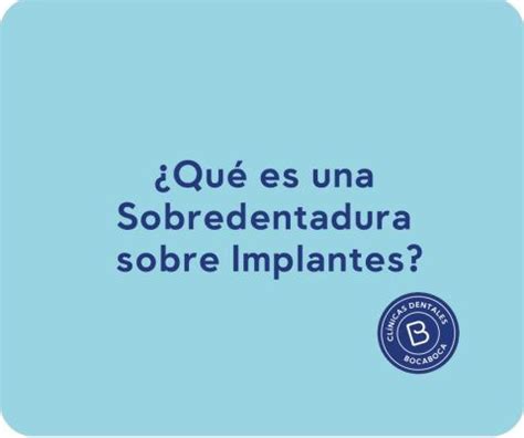 Qu Es Una Sobredentadura Sobre Implantes Cl Nica Dental M Laga