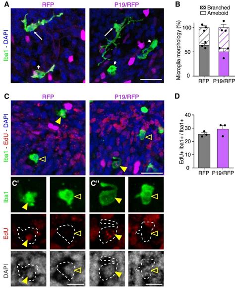 Fig S P Overexpression Does Not Affect Microglia Morphology Nor