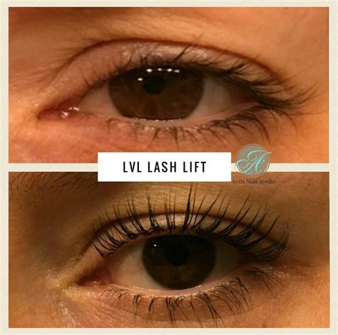 Lash Lift Before and After ~ Avila Skin Studio