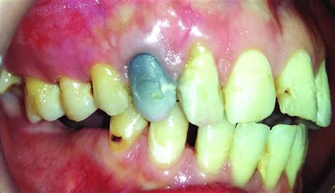 Preoperative Clinical Photograph Showing The Right Lateral View Of Download Scientific Diagram