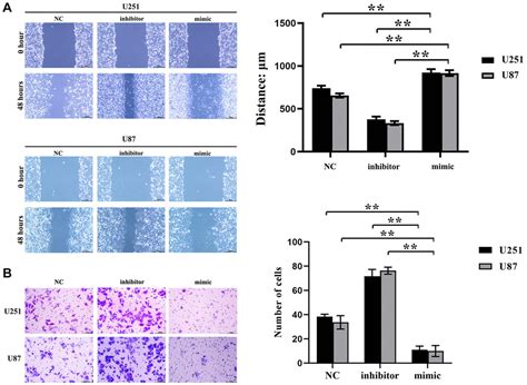 Has Mir P Inhibits The Proliferation And Migration Of Glioma Cells