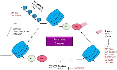 Epigenetics In Prostate Cancer Treatment