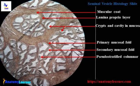 Seminal Vesicle Histology - Histological Features of Vesicular Gland Slide with Labeled Diagram ...