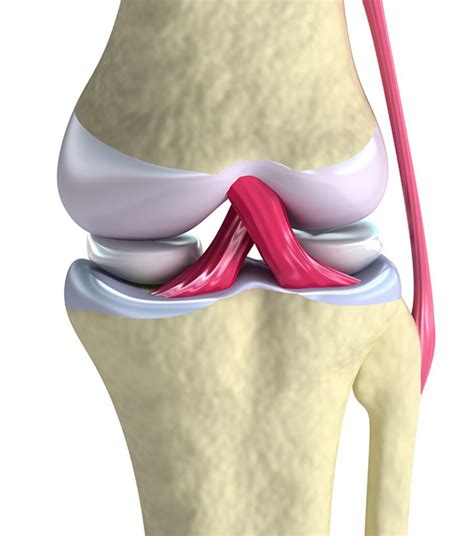 Ligamentos Cruzados Cl Nica V Ctor D Ez