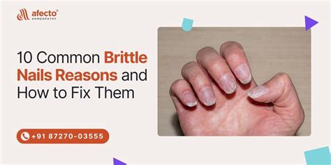 10 Common Brittle Nails Reason And How To Fix Them