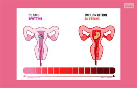 Plan B Spotting VS Implantation Bleeding What S The Difference