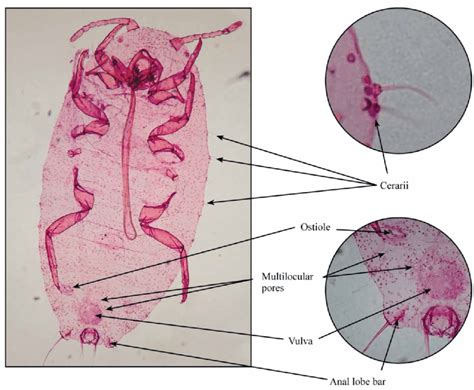 Microscopic Permanent Slide Of Adult Female Of Planococcus Vovae Download Scientific Diagram