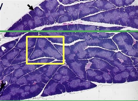 Histology Of Lymphoid Tissues Flashcards Quizlet