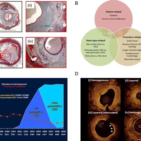 Pdf Stent Thrombosis And Restenosis What Have We Learned And Where