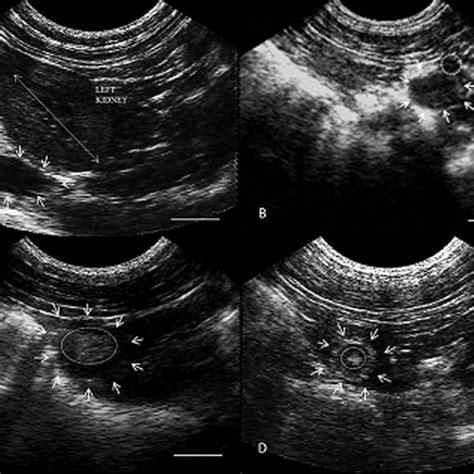 Serum Estradiol Pg Ml And Progesterone Ng Ml Profiles Of Cyclic