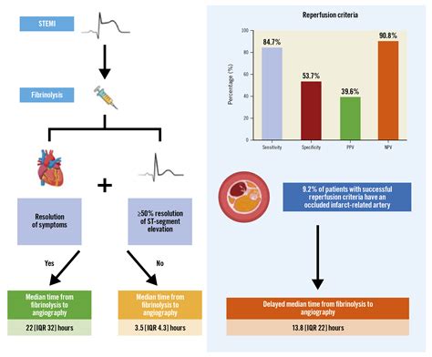 Diagnostic Accuracy Of Reperfusion Criteria Following Fibrinolysis For St Elevation Myocardial