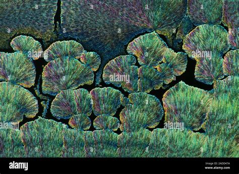 Vitamin C Crystals Polarized Light Micrograph Of Crystals Of Vitamin C