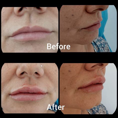 Chirurgie Plastica Chirurgie Estetica Pitesti