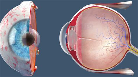 Cataract Surgery Inside The Or Youtube