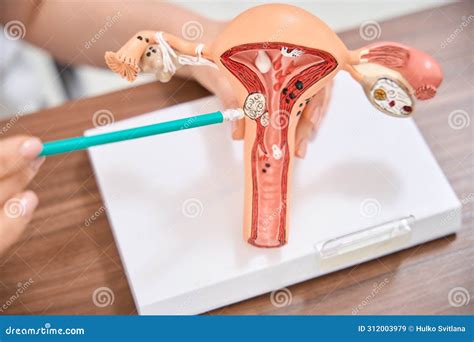 Gynecologist Showing Releasing Of Egg From An Ovary On The Vagina Model