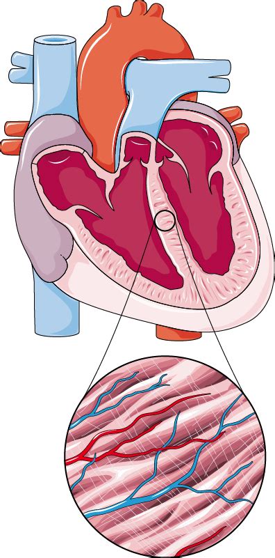 ¿qué Es Una Miocarditis ¿puede Tener Complicaciones Graves