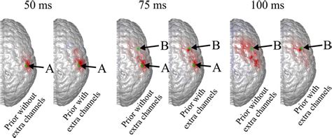 Comparison Of Eeg Reconstruction In Fig And Eeg Reconstruction