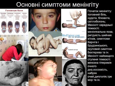 Учні 10А класу Довженко Ярослава Лощонова Анна Троценко