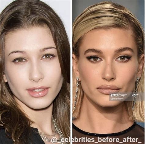 Hailey Bieber How To Make Hair Celebrities Before And After Celebrity Plastic Surgery