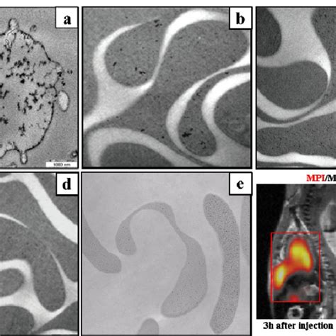 Tem Image Of Red Blood Cells Rbcs Labeled By A Citrate Coated