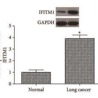 Ifitm Is Highly Expressed In Lung Cancer Tissues And Cell Lines A