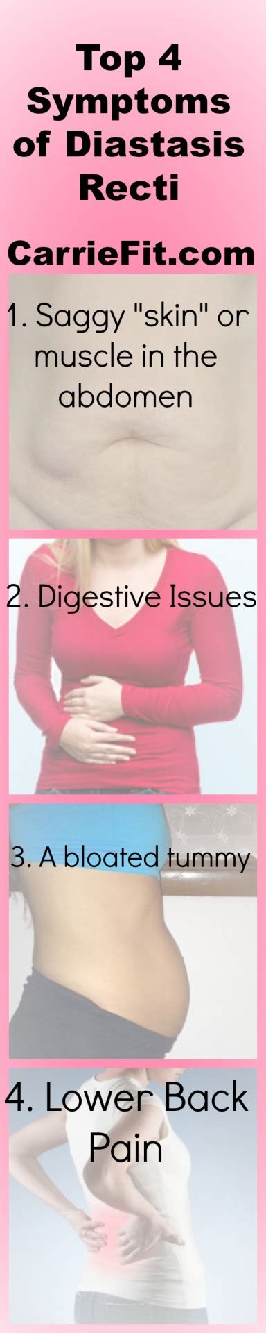 The CarrieFit Blog — Top 4 Symptoms of Diastasis Recti: Many people are...