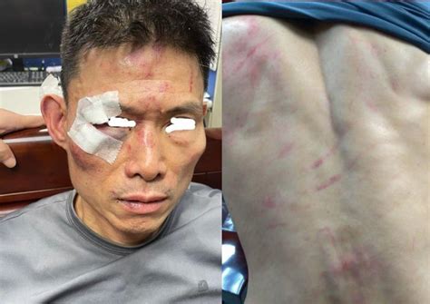 扯！新北警方「誤認通緝犯」 無辜男當街被拖行「打到全身是傷」 民視新聞網