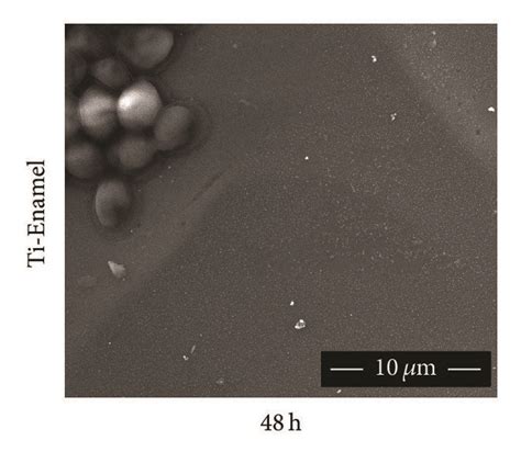 Sem Images 10000x Of C Albicans Biofilm Developed On Different Download Scientific Diagram