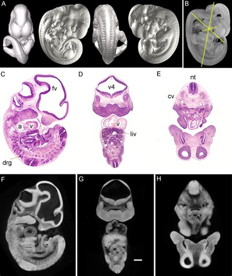 Filemouse E115png Embryology