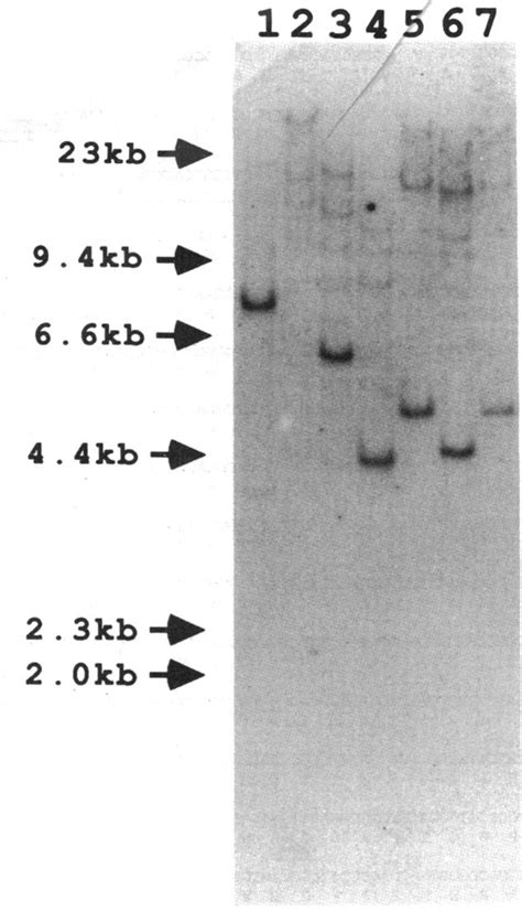 Southern Blot Analysis Of Chromosomal Dna Digested With Various