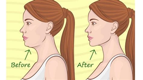 Neck Fat No More Discover The Best Natural Ways To Get Rid Of Neck Fat Quickly Youtube