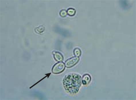 Cm Lec Microscopic Examination Of Urine Flashcards Quizlet